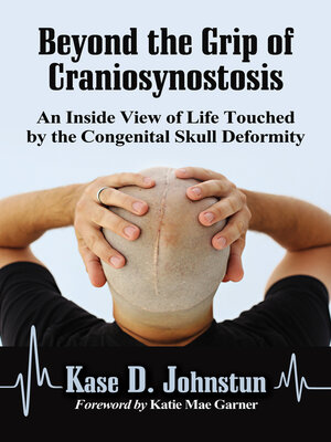 cover image of Beyond the Grip of Craniosynostosis